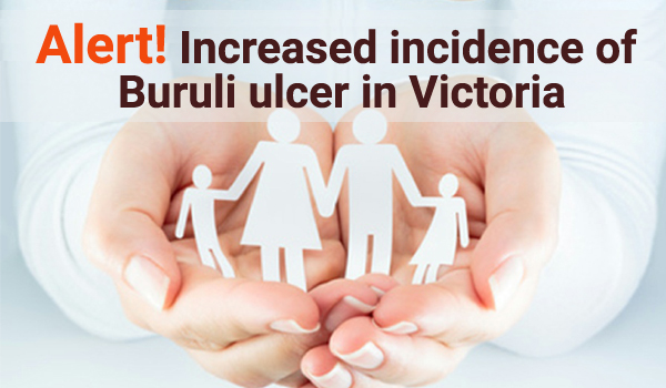 Be Alert! Increased incidence of Buruli ulcer in Victoria.